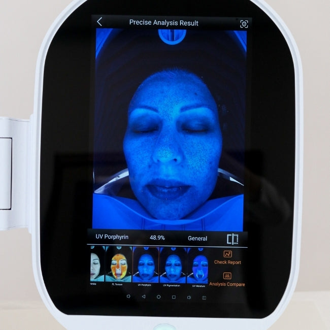 Zemits VeraFace Skin Analyzer System